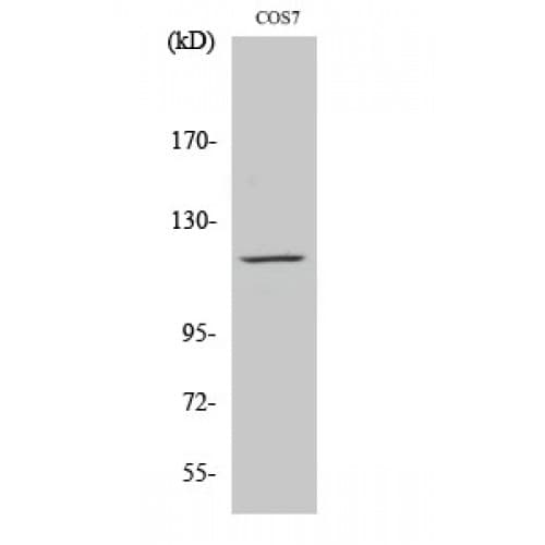 Polyclonal Rabbit anti-Human PTK2B / PYK2 Antibody (520-600 aa, IHC, WB)