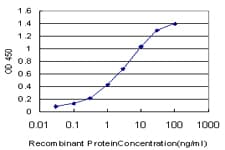 IHC-plus™ NME1 / NM23 Antibody (clone 1D7)