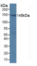 PALLD / Palladin Antibody (aa1137-1383, APC)