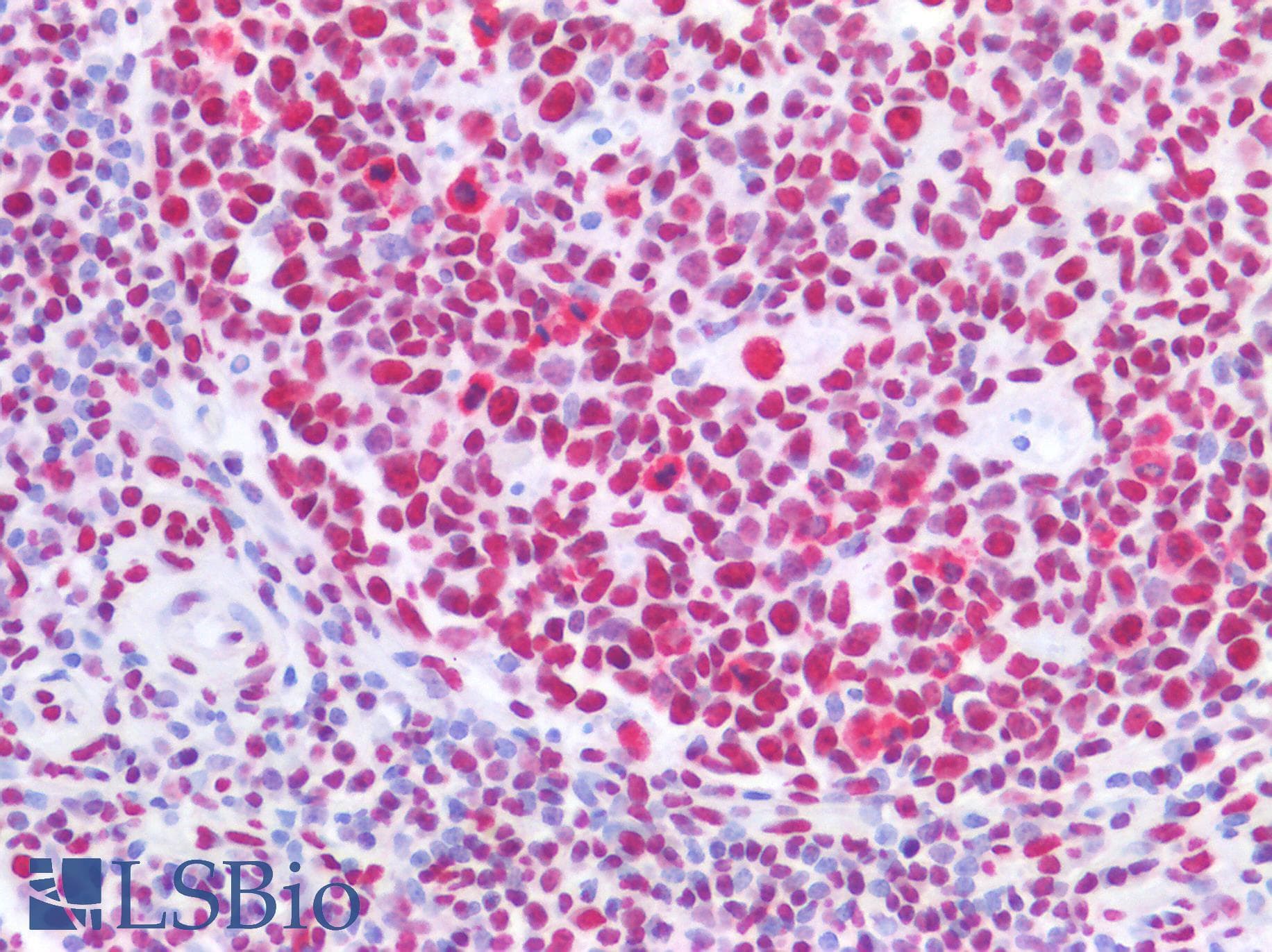 IHC-plus™ Monoclonal Mouse anti-Human PTBP3 / ROD1 Antibody (clone OTI5C9, aa300-552, IHC, WB)