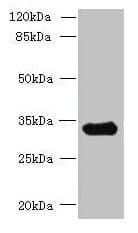 CCDC106 Antibody (Coiled-coil domain)