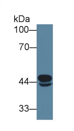 MCAD / ACADM Antibody