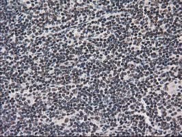 PRKCE / PKC-Epsilon Antibody (clone OTI1B4)