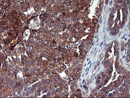 ENPEP / Aminopeptidase A Antibody (clone OTI1E3)