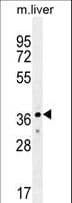 UBXD4 / UBXN2A Antibody (aa166-195)