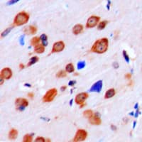 KPI-2 / LMTK2 Antibody (Internal)
