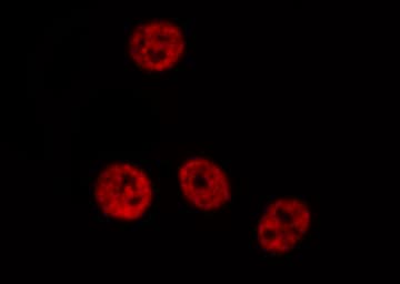 Polyclonal Rabbit anti-Human PDCD4 Antibody (phospho-Ser457, IHC, IF, WB)