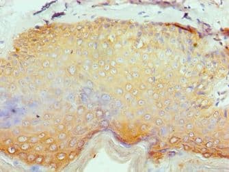 Polyclonal Rabbit anti-Human SERPINB1 Antibody (aa100-379, IHC, WB)