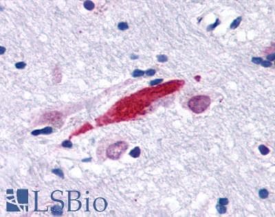 PathPlus™ GPER1 / GPR30 Antibody (N-Terminus)