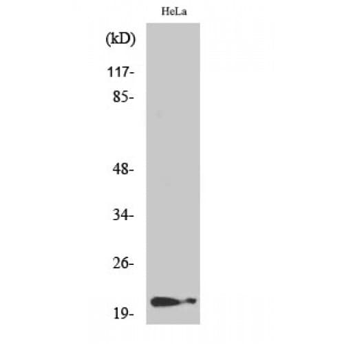 Polyclonal Rabbit anti-Human CDKN1A / WAF1 / p21 Antibody (80-160 aa, IHC, WB)