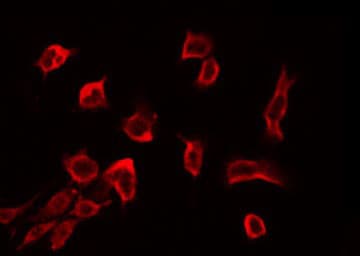 Polyclonal Rabbit anti-Human RSU1 Antibody (IF, WB)