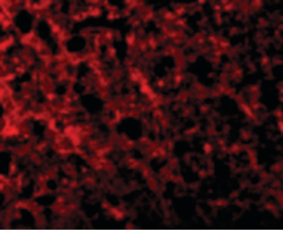 ANTXR1 / TEM8 Antibody