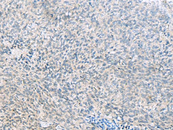 C1orf112 Antibody