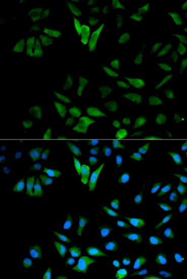 ENO1 / Alpha Enolase Antibody