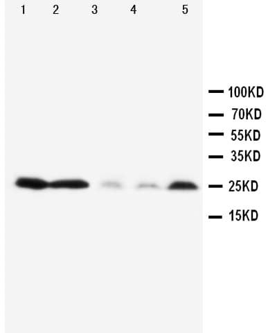 PTN / Pleiotrophin Antibody (aa150-168)