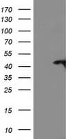 TBC1D21 Antibody (clone OTI6F9)