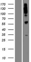 Human UGT1A8 Protein (Over-Expression Lysate Myc-DDK (Flag))