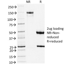 TLE1 / TLE 1 Antibody (clone TLE1/2051)