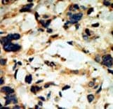 Polyclonal Rabbit anti-Human SGK2 Antibody (aa395-426, IHC, WB)