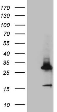 CRP / C-Reactive Protein Antibody (clone OTI6F3)