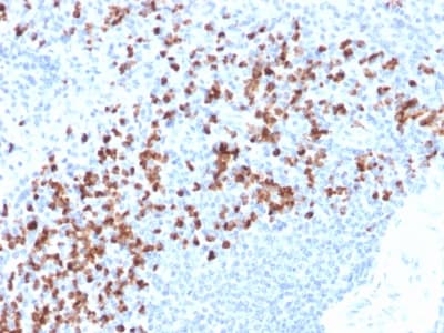 MMP9 / Gelatinase B Antibody (clone rMMP9/1769, Azide-free, Carrier-free)