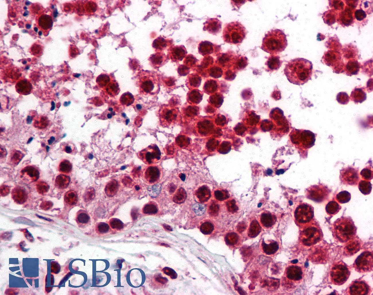 IHC-plus™ Polyclonal Rabbit anti-Human SREBF2 / SREBP2 Antibody (aa455-469, IHC, WB)