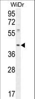 Polyclonal Rabbit anti-Human DUS4L Antibody (aa141-170, WB)