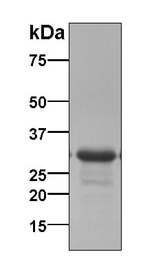 Human WFDC2 / HE4 Protein (Recombinant TRX-6His, N-terminus)