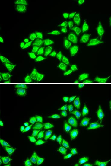 Polyclonal Rabbit anti-Human TPD52L1 Antibody (IHC, IF, WB)