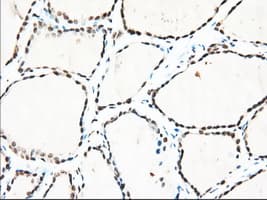 ERIC-1 / TACC3 Antibody (clone OTI1E8)