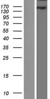 WHSC1 / NSD2 Protein (Over-Expression Lysate Myc-DDK (Flag))
