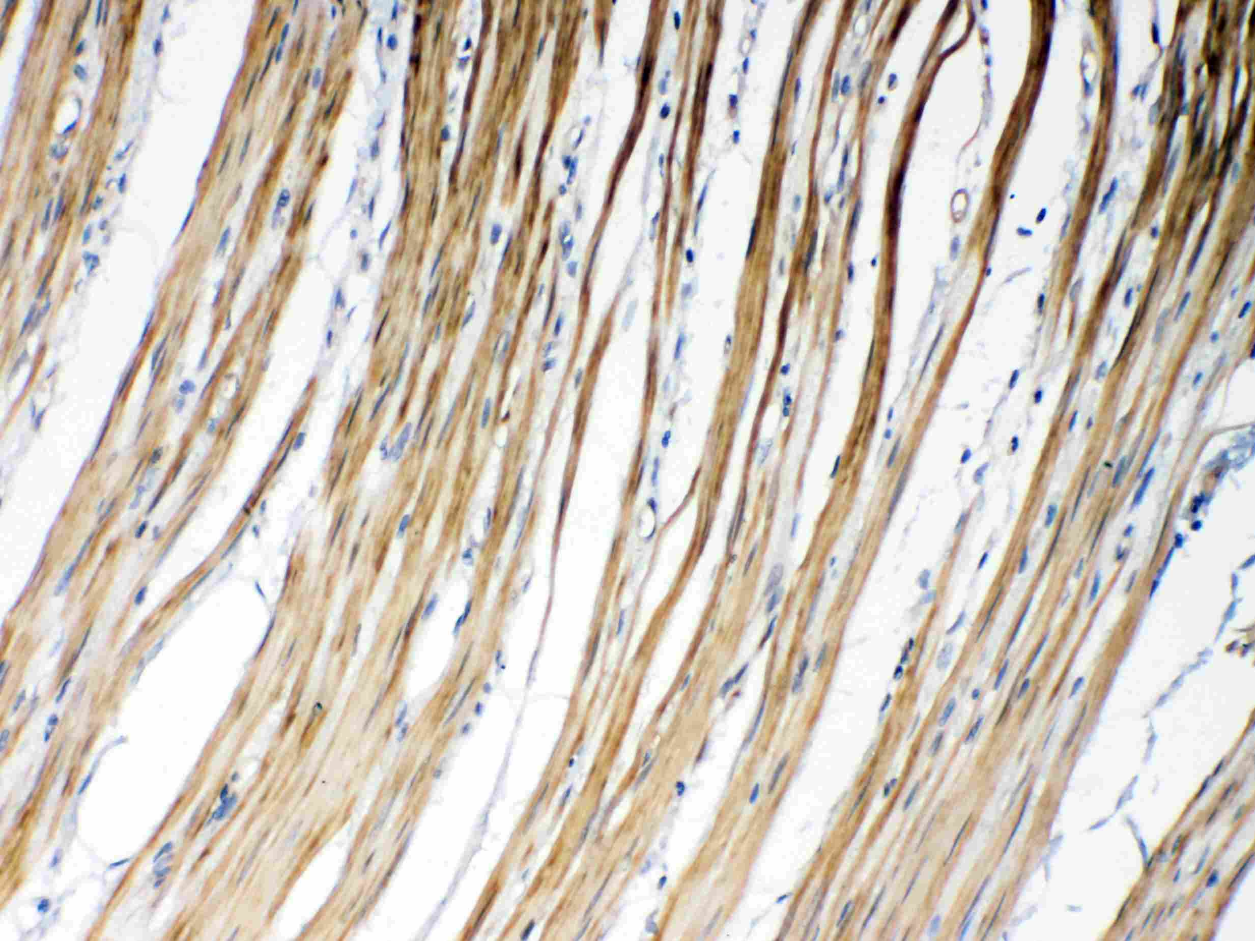 Polyclonal Rabbit anti-Human GJC1 / CX45 / Connexin 45 Antibody (IHC, WB)