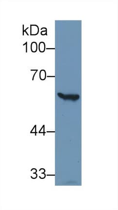 G6PD Antibody (aa1-515)