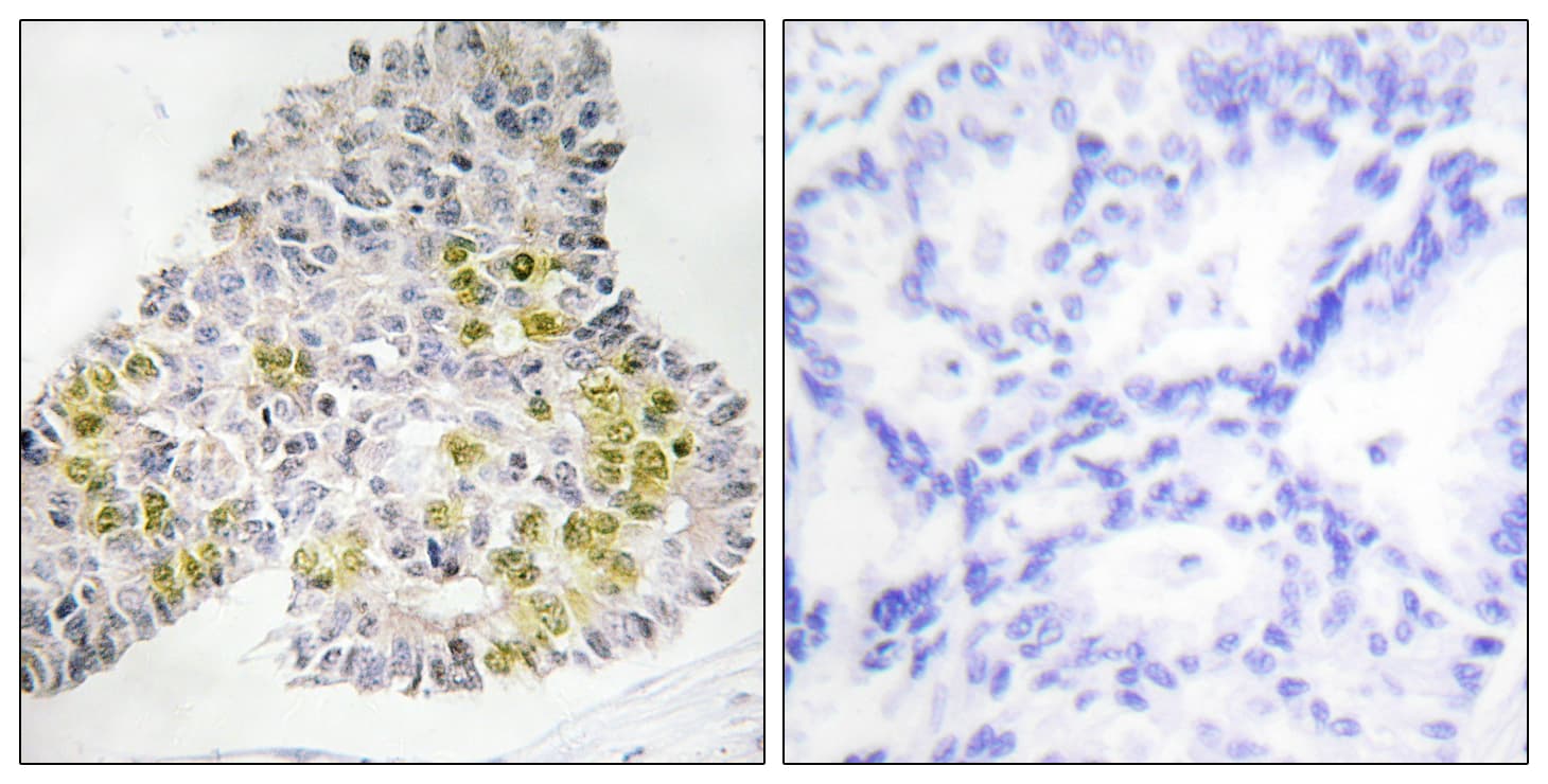 STK11 / LKB1 Antibody (aa384-433)
