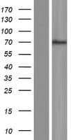 POF1B Protein (Over-Expression Lysate Myc-DDK (Flag))