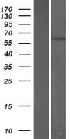 CNOT6L Protein (Over-Expression Lysate Myc-DDK (Flag))