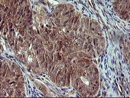 POMC / Proopiomelanocortin Antibody (clone OTI2B2)