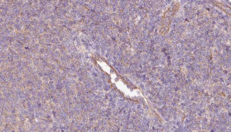 PHGDH Antibody