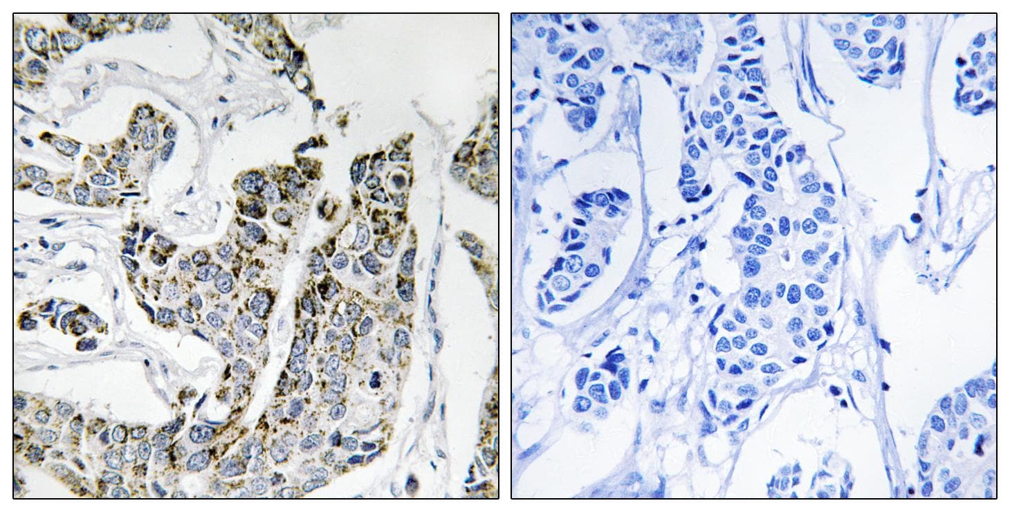 BLK Antibody (phospho-Tyr501)