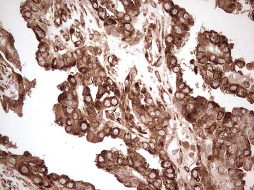 Monoclonal Mouse anti-Human YBX1 / YB1 Antibody (clone OTI11A7, IHC, WB)