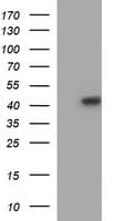 SERPINB3 Antibody (clone OTI1G1)