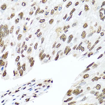 HNRNPR / hnRNP R Antibody