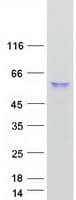 Human CPVL Protein (Recombinant Myc-DDK (Flag))