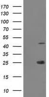 TASP1 Antibody (clone OTI1C12, Carrier-free)