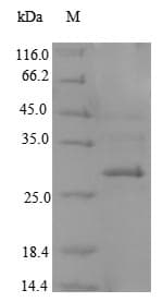Mouse CD207 / Langerin Protein (Recombinant 6His, N-terminus)