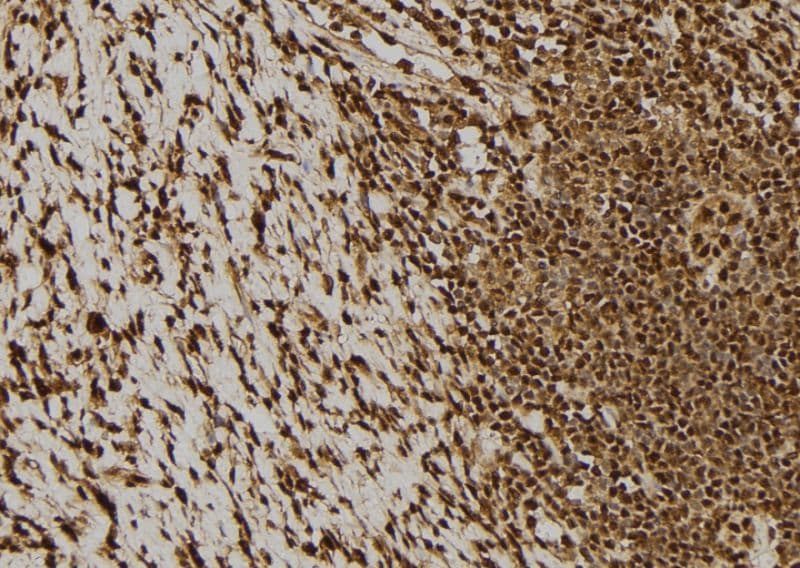 BCL2L1 / BCL-XL Antibody