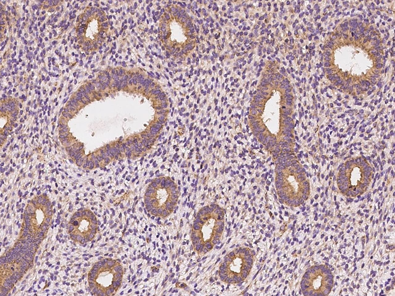 Polyclonal Rabbit anti-Human NIN / Ninein Antibody (IHC)