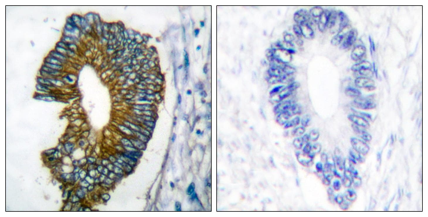 KRT18 / CK18 / Cytokeratin 18 Antibody