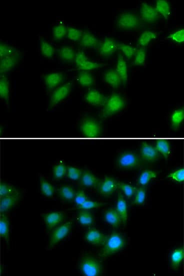 Polyclonal Rabbit anti-Human POU2AF1 / BOB1 Antibody (IHC, IF, WB)