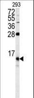 Polyclonal Rabbit anti-Human FKBP1B / FKBP12.6 Antibody (aa16-46, IHC, IF, WB)